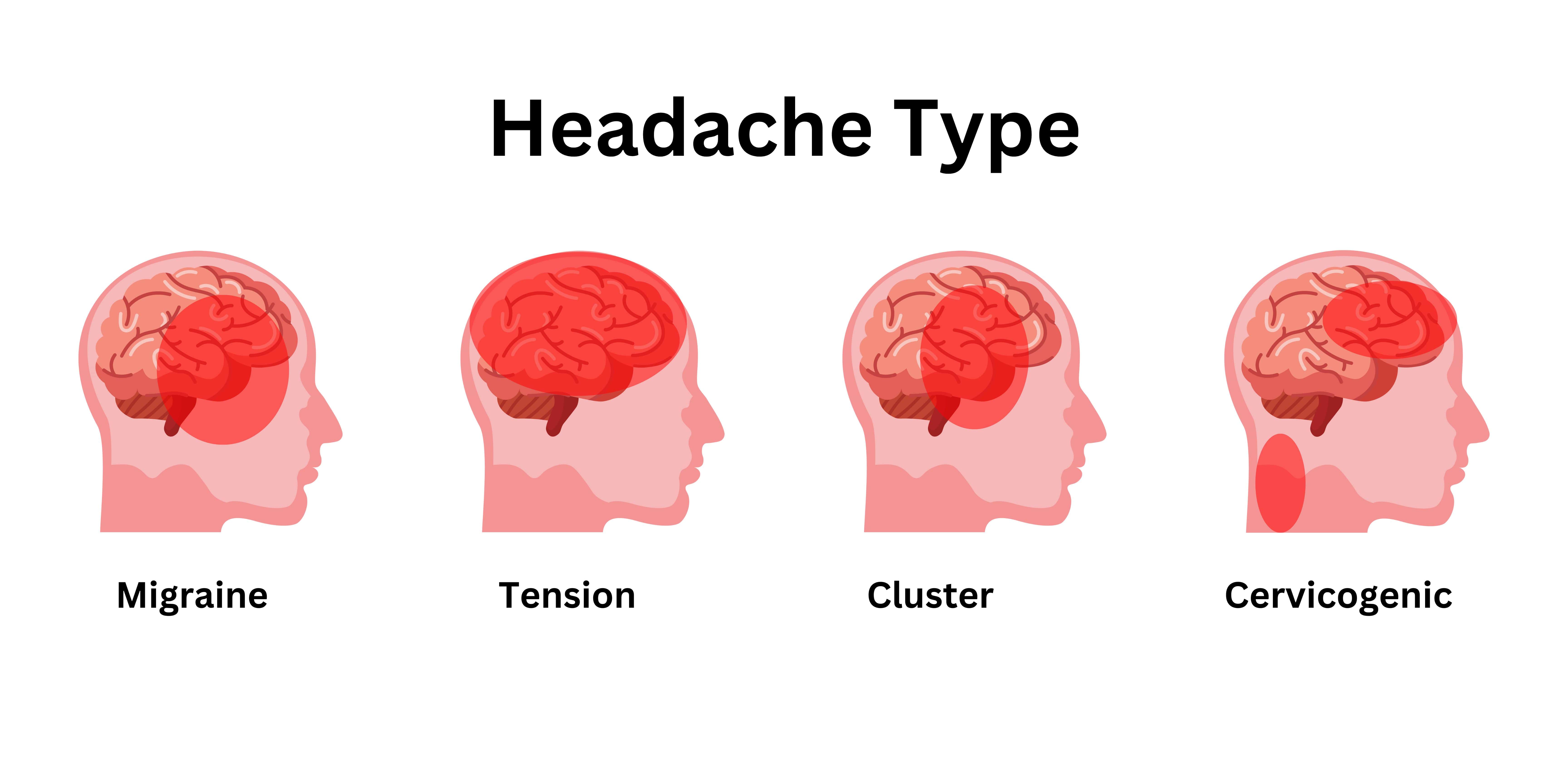 Conquer Chronic Headaches: When to See a Specialist