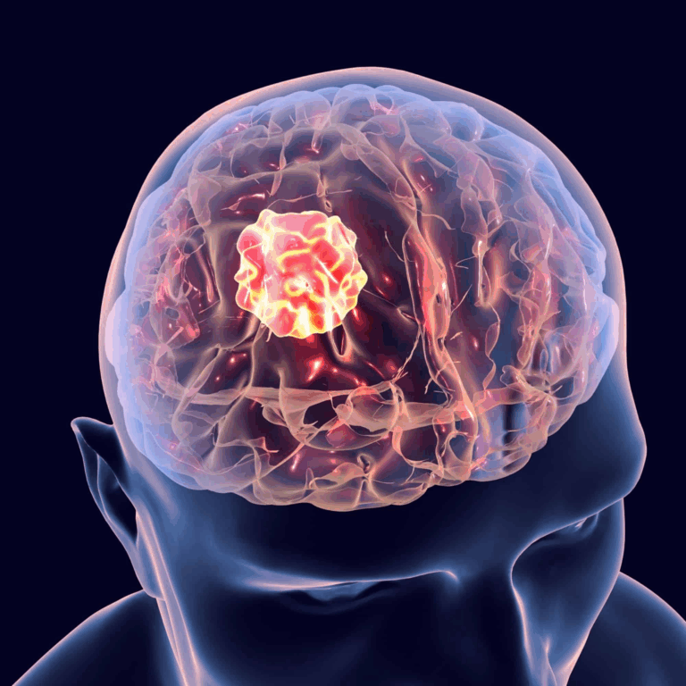 Image brain tumor w alpha