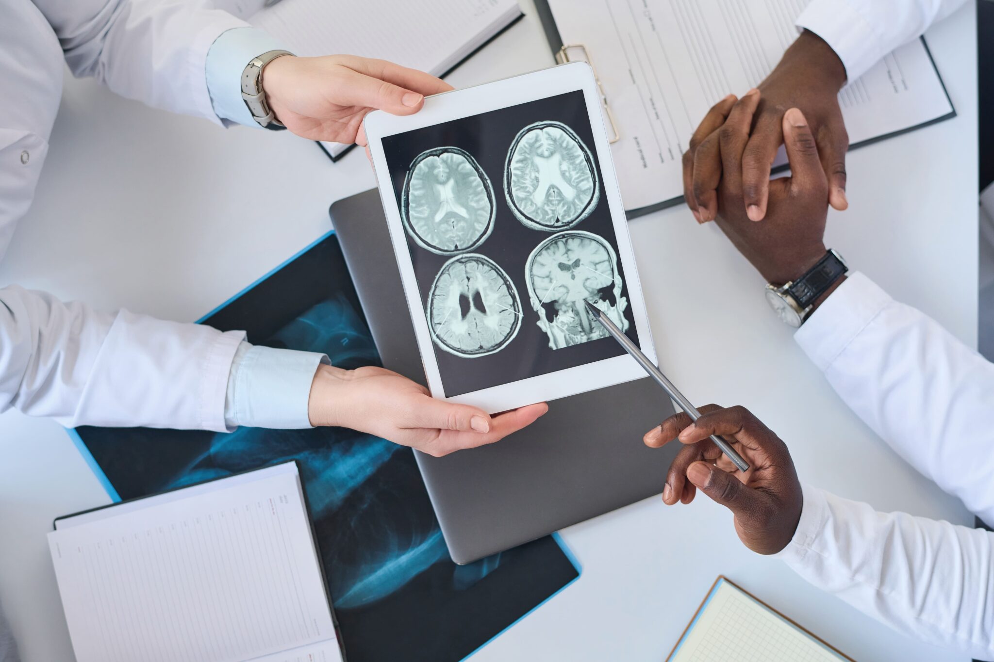 doctors examining brain tomography image in team 2026 01 08 00 15 14 utc