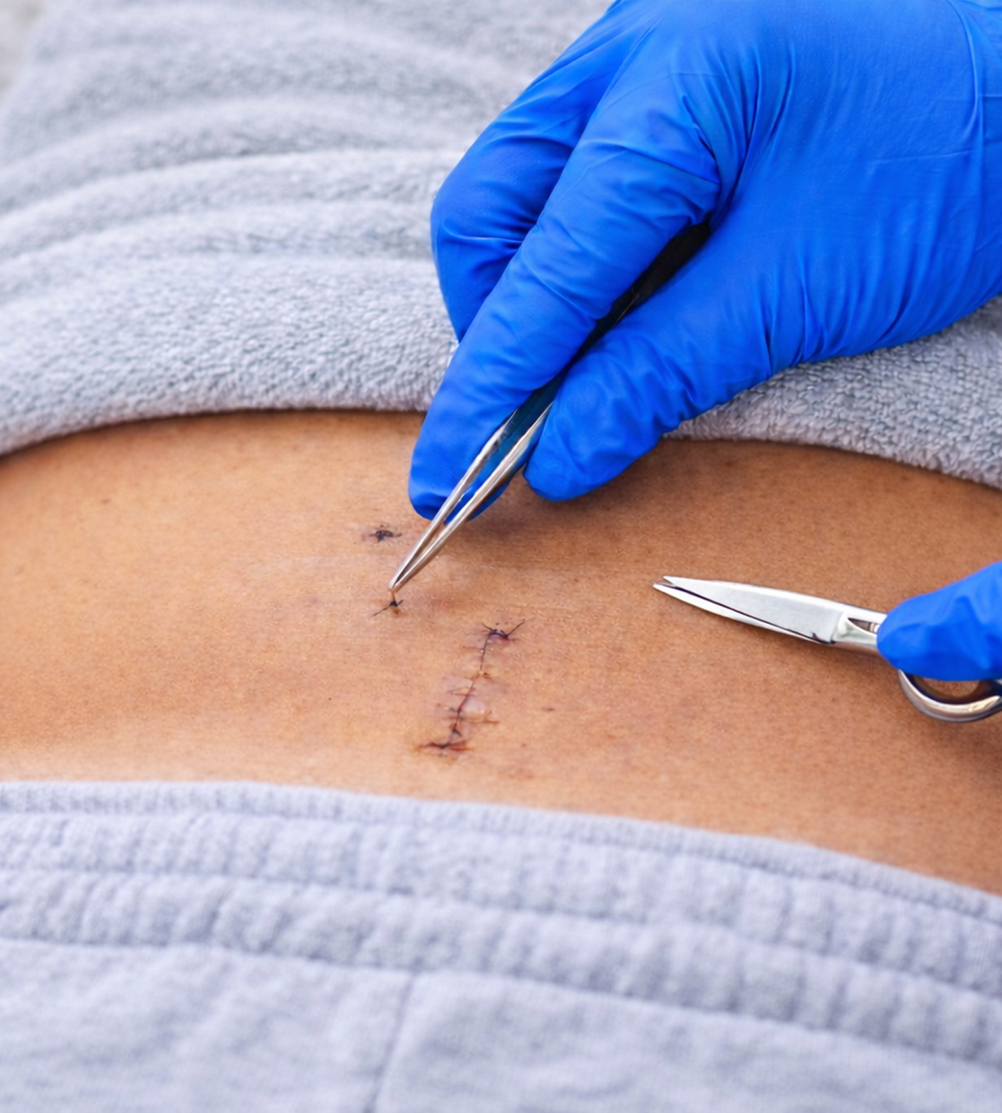 Precision Treatment Spine MinimallyInvasive Hero Desktop